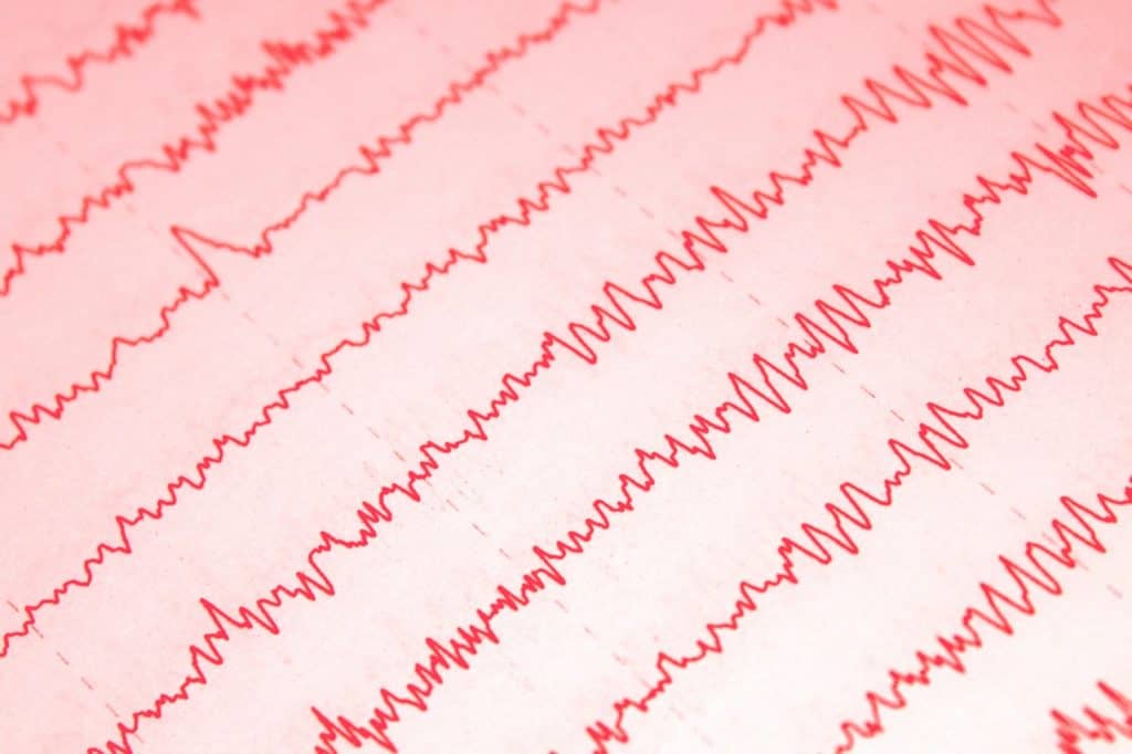 EEG