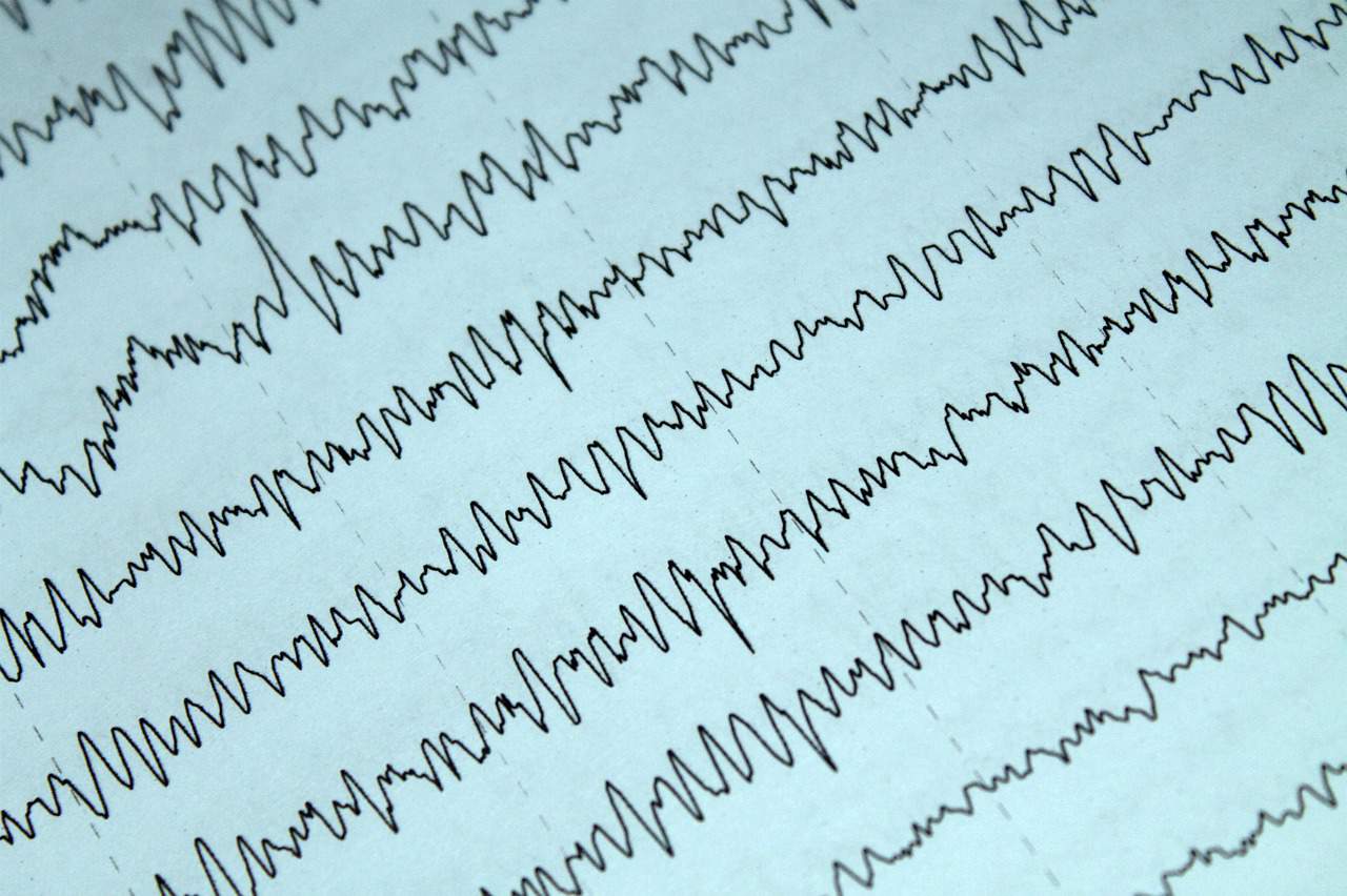בדיקות נוירולוגיות: EMG ובדיקות EEG